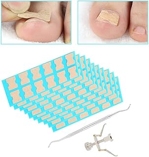 Remendo De Unha Encravada, Pedicure Remendo De Correção De Unha Encravada Empurrador De Cutícula, Cortador De Unha Para Encaixes, Botões E Remendos Aparador Cortador Corretor Fixador