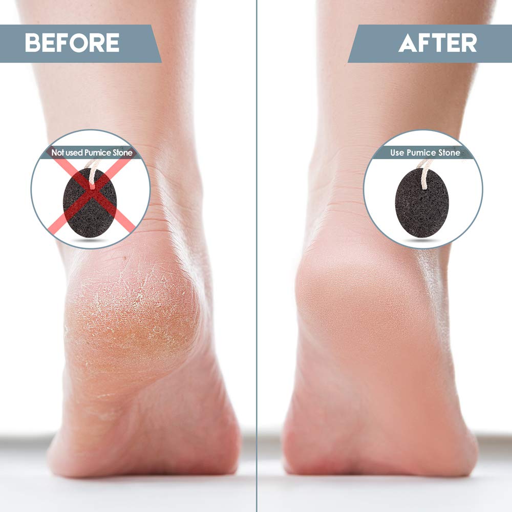 Pumice Stone Before And After