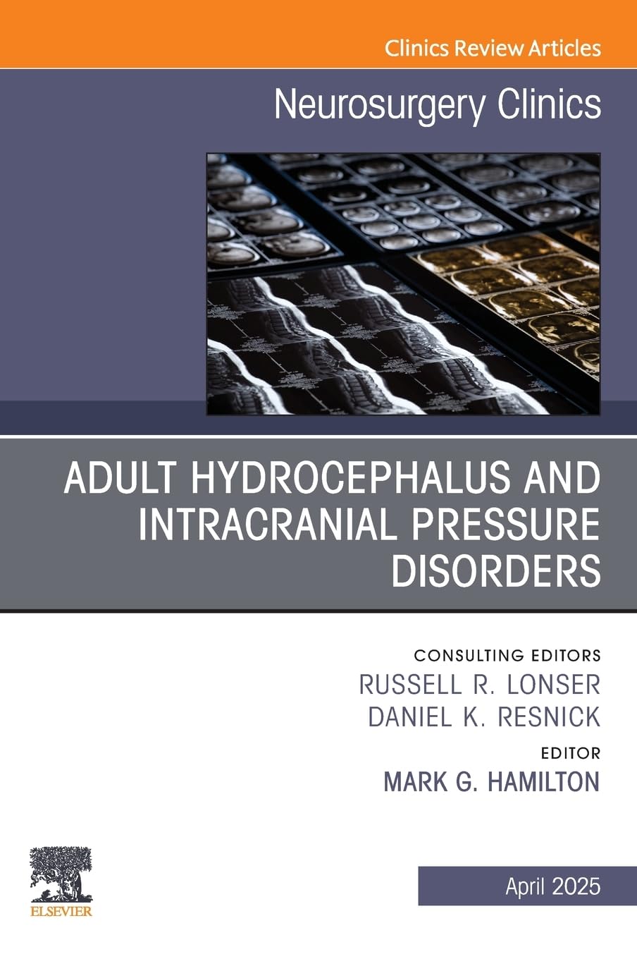 Adult Hydrocephalus and Intracranial Pressure Disorders, An Issue of Neurosurgery Clinics of North America: Volume 36-2 (The Clinics: Surgery, Volume 36-2)