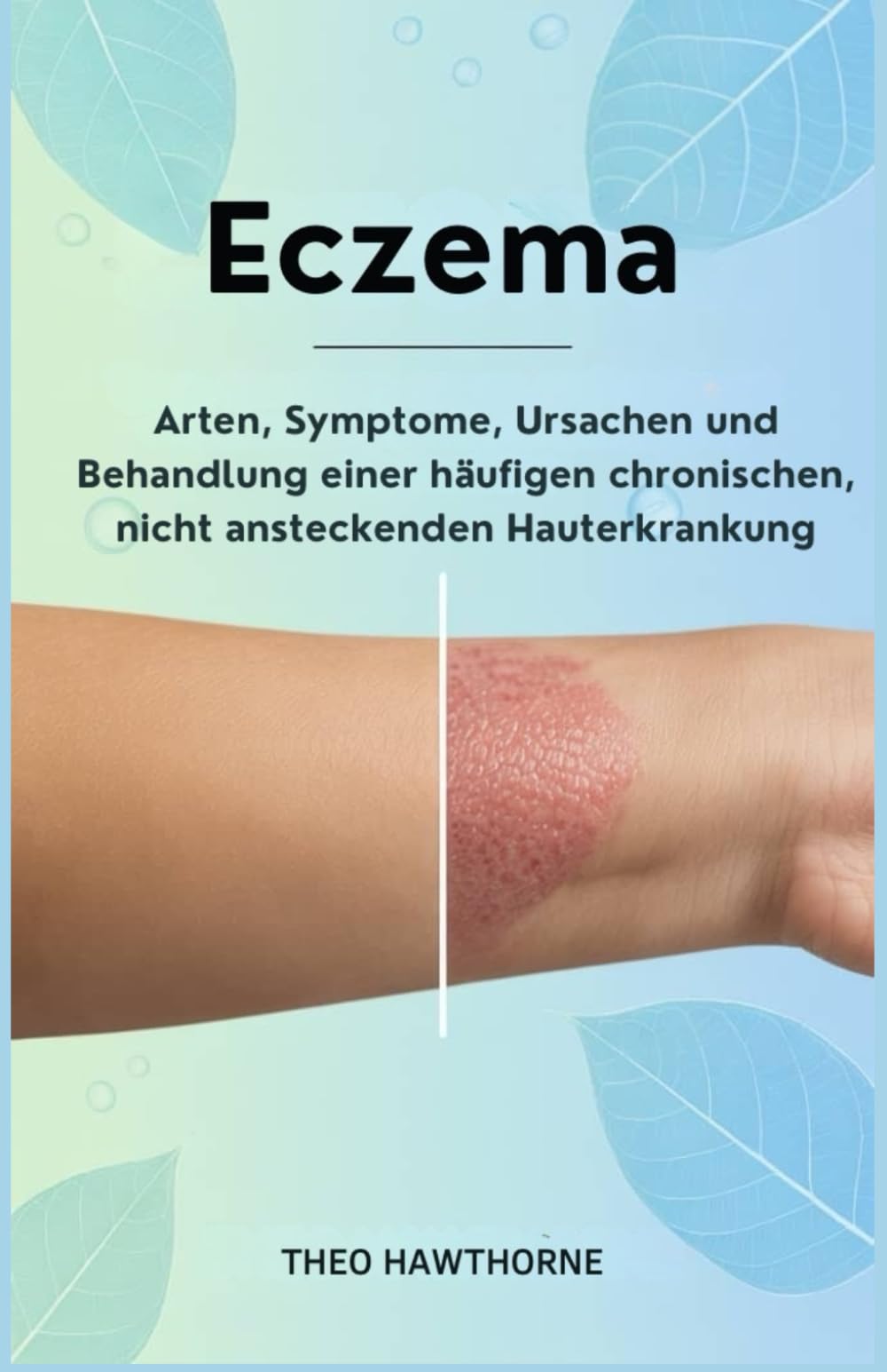 Eczema: Arten, Symptome, Ursachen und Behandlung einer häufigen chronischen, nicht ansteckenden Hauterkrankung