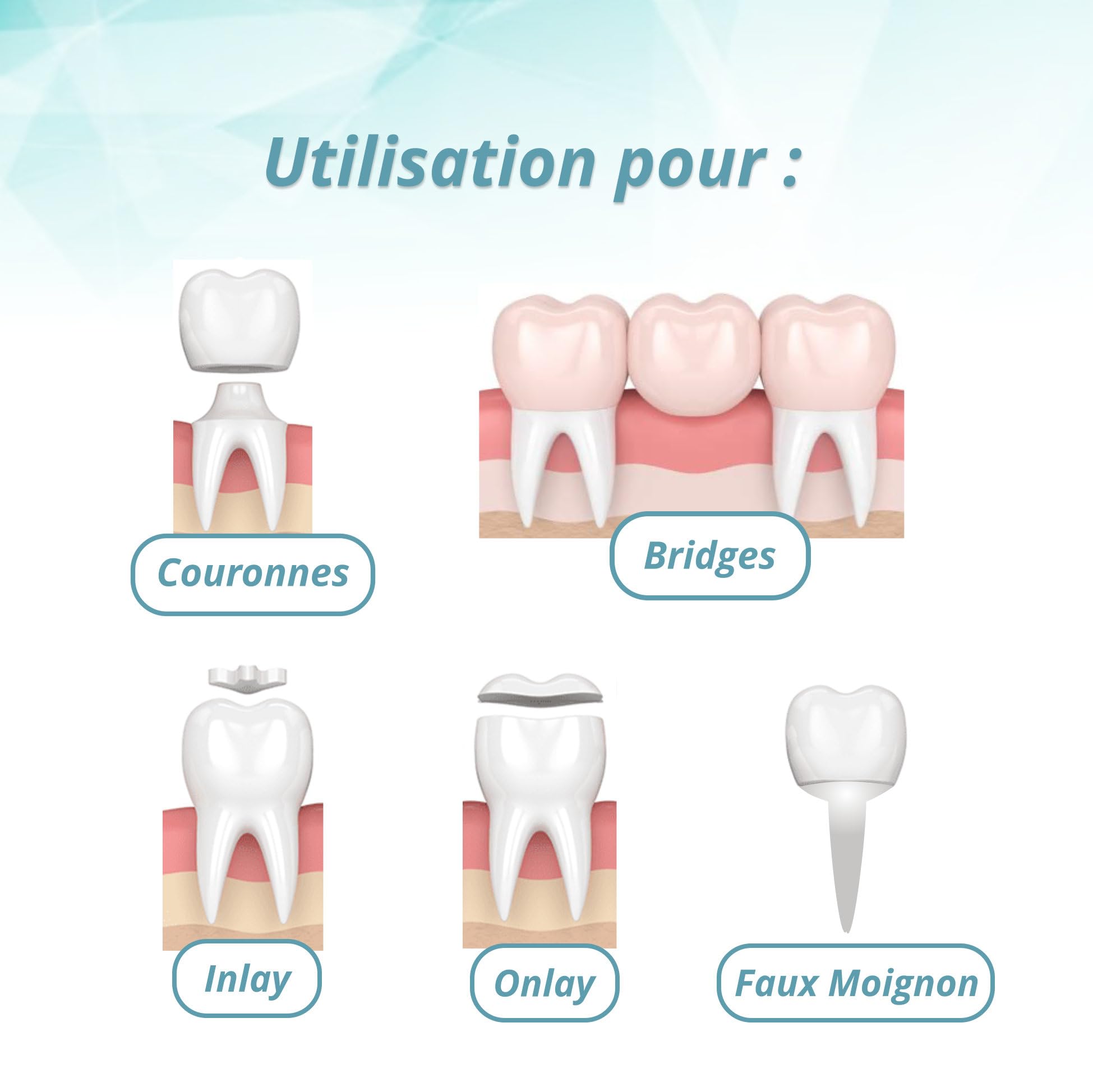 Ciment dentaire semi-permanent – Colle dentaire forte pour couronnes et bridges – Adhésif prothèse dentaire professionnel”