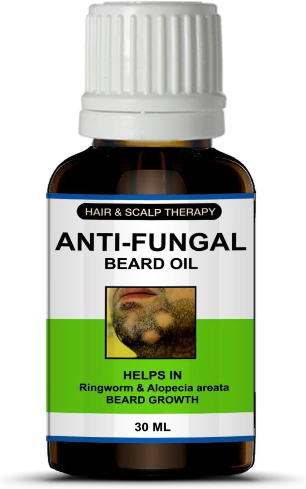 Sun's Heart Hair & Scalp Therapy Anti-Fungal Beard Oil (Helps in Ringworm, Alopecia Areata & Beard Growth) 30ml