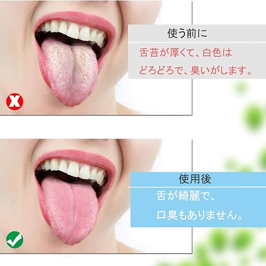 Amazon シリコン 舌磨き 舌ブラシ 2本セット 舌クリーナ ー 口内ケア したみがき ブラシ 舌専用ブラシ 舌苔清掃 グリーン ピンク Proteeth 舌クリーナー 通販