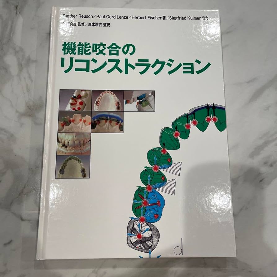 【絶版】機能咬合のリコンストラクション Amazon.co.jp: 絶版機能咬合のリコンストラクション.055hp