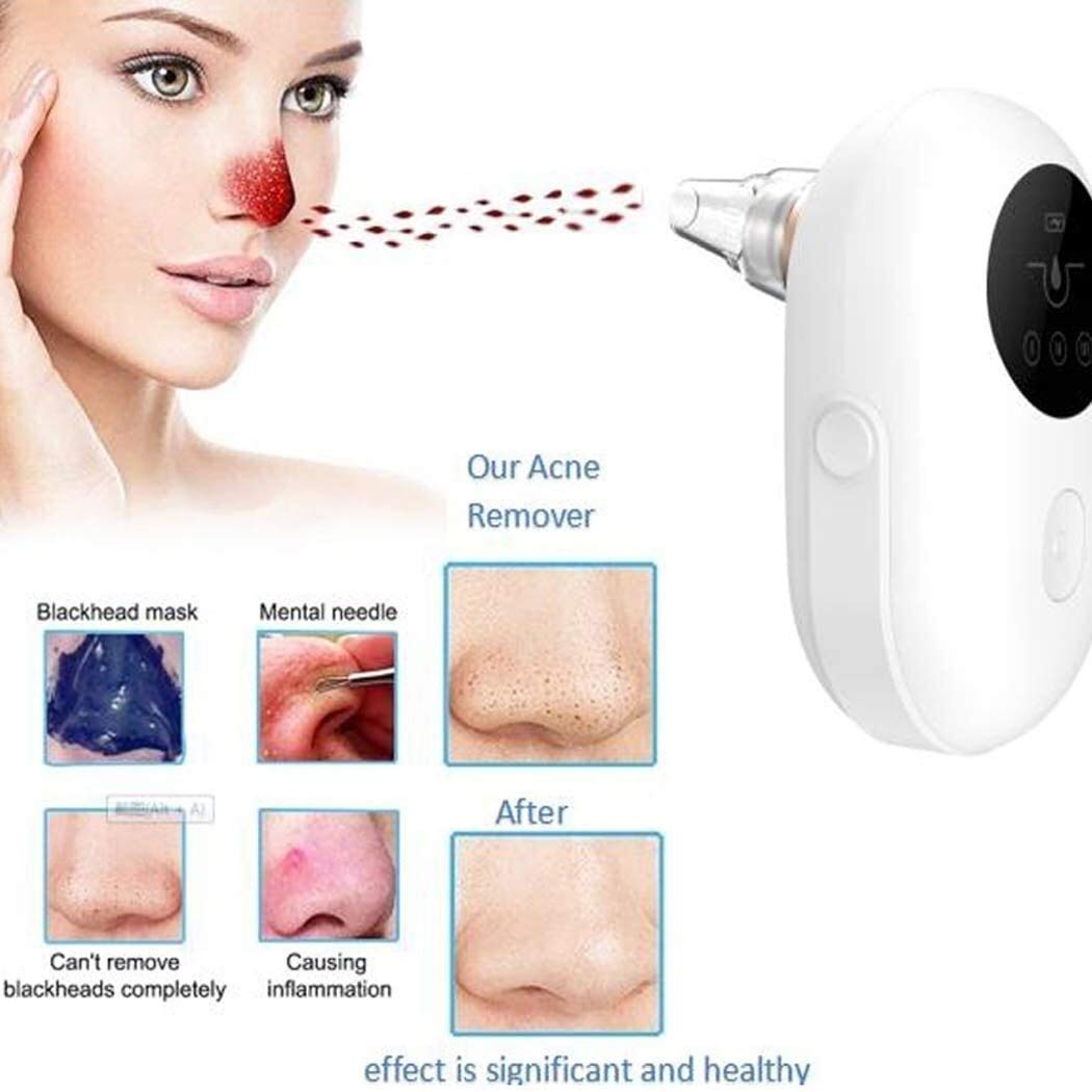 Blackhead Remover Aspirate Aggiornamento a vuoto Strumento di rimozione Blackhead Blackhead Aspirapo-USB Ricaricabile Aspiratore Aspiratore Astratto con display a LED Forza di aspirazione 3 Moda