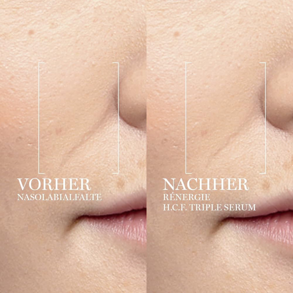 Lancôme Rénergie H.C.F. Triple Serum, Anti-Aging Gesichtspflege | Gesichtsserum mit Vitamin C, Hyaluronsäure und Niacinamid, für sichtbar straffere Haut und mehr Volumen, strahlendes Finish