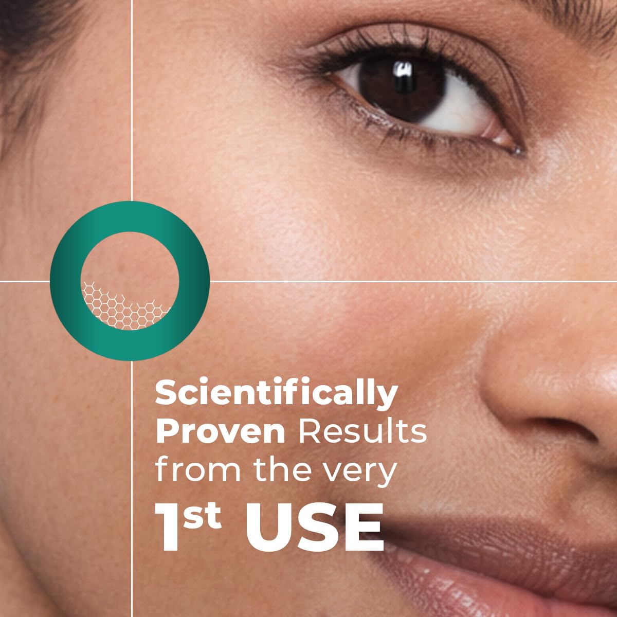 Amazon.com: Acne Spot Corrector Gel Serum : Beauty & Personal Care