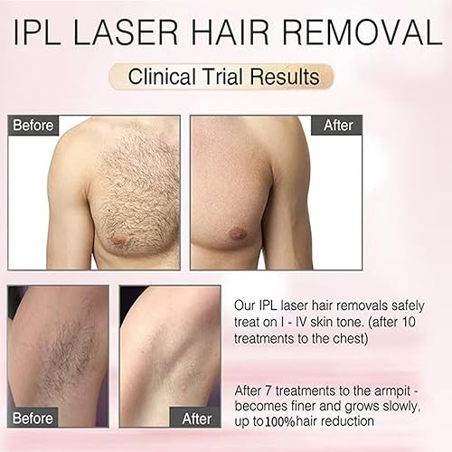 Miniatura 4 de Depilación láser para mujeres y hombres, depilación láser permanente IPL 300,000 flashes, dispositivo removedor de vello para uso doméstico para