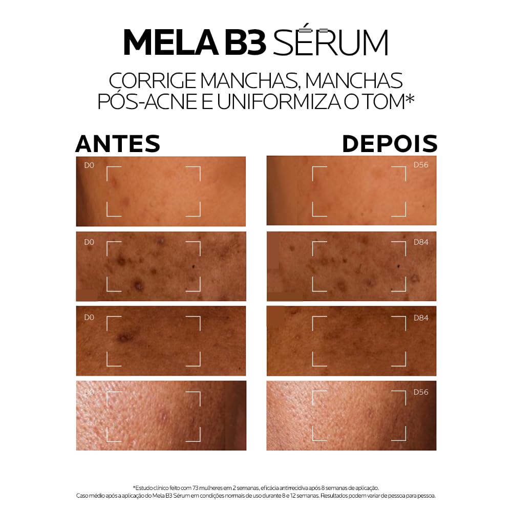 Top 3 Creme e Séruns de Cicatrização da La Roche-Posay em 2026: Qual Escolher para Pele Irritada, Manchas e En