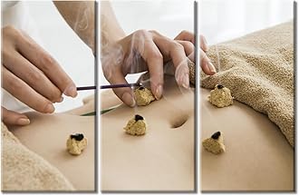 TUMOVO 3 Panels Moxibustion Canvas Wall Art Moxa Moxibustion Posters Paintings for Wall Decorations Nosocomium Artwork Canvas Photo Stretched and Framed Ready to Hang (60" Wx40 H)