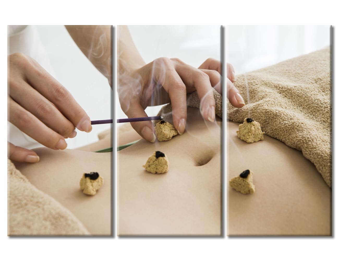 TUMOVO 3 Panels Moxibustion Canvas Wall Art Moxa Moxibustion Posters Paintings for Wall Decorations Nosocomium Artwork Canvas Photo Stretched and Framed Ready to Hang (60" Wx40 H)