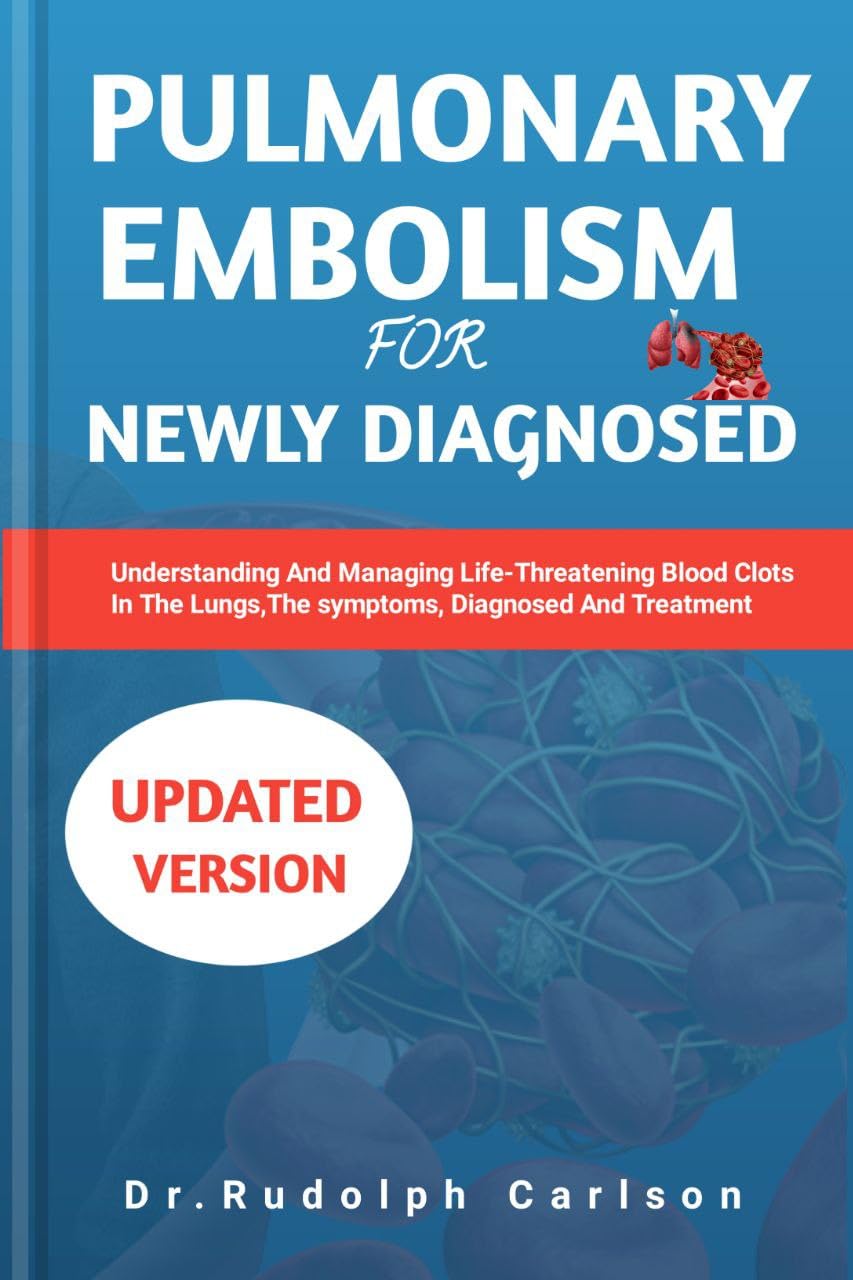 PULMONARY EMBOLISM FOR NEWLY DIAGNOSED Understanding And Managing Life