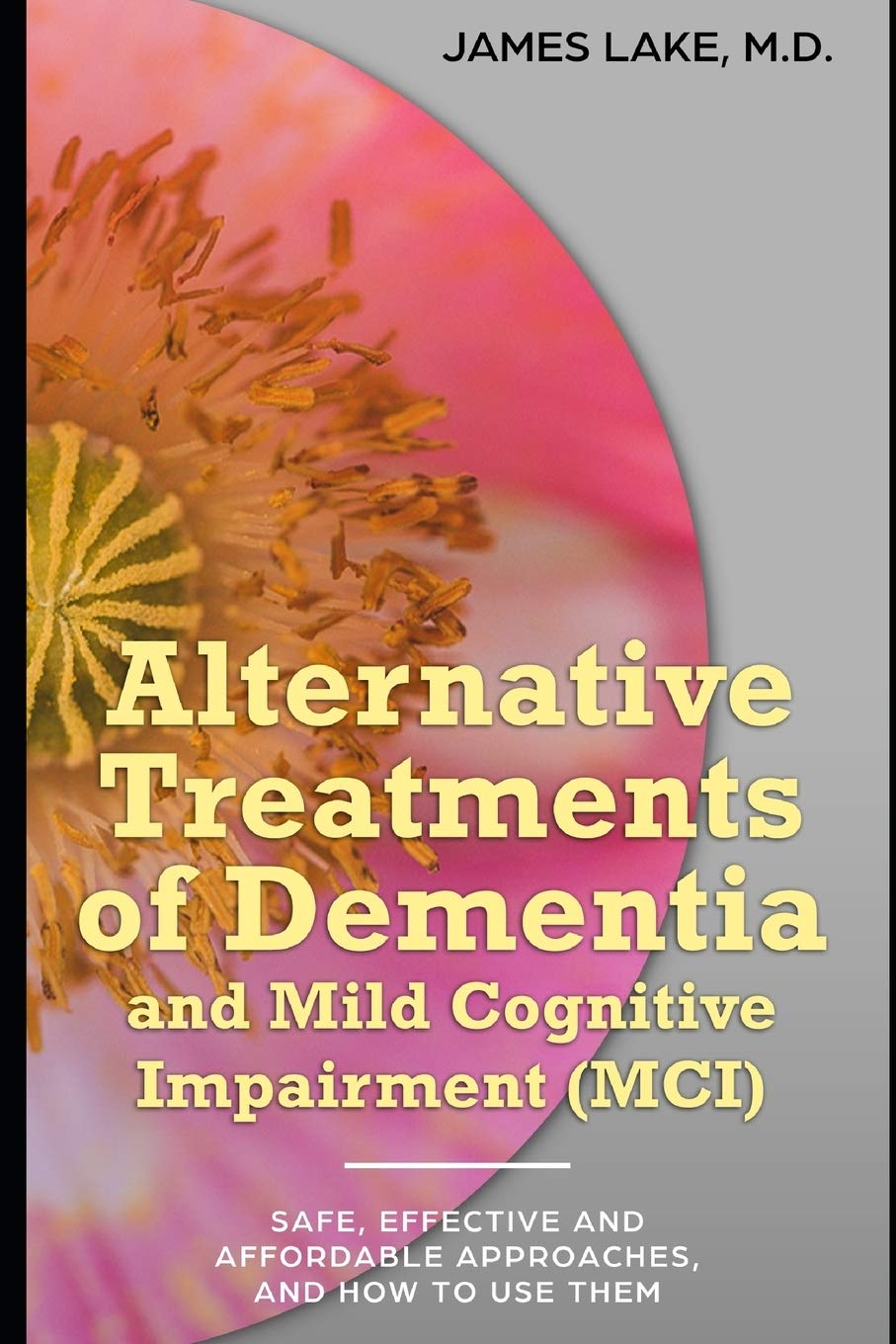Alternative Treatments of Dementia and Mild Cognitive Impairment (MCI): Safe, effective and affordable approaches and how to use them: 5 (Alternative and Integrative Treatments in Mental Health Care)