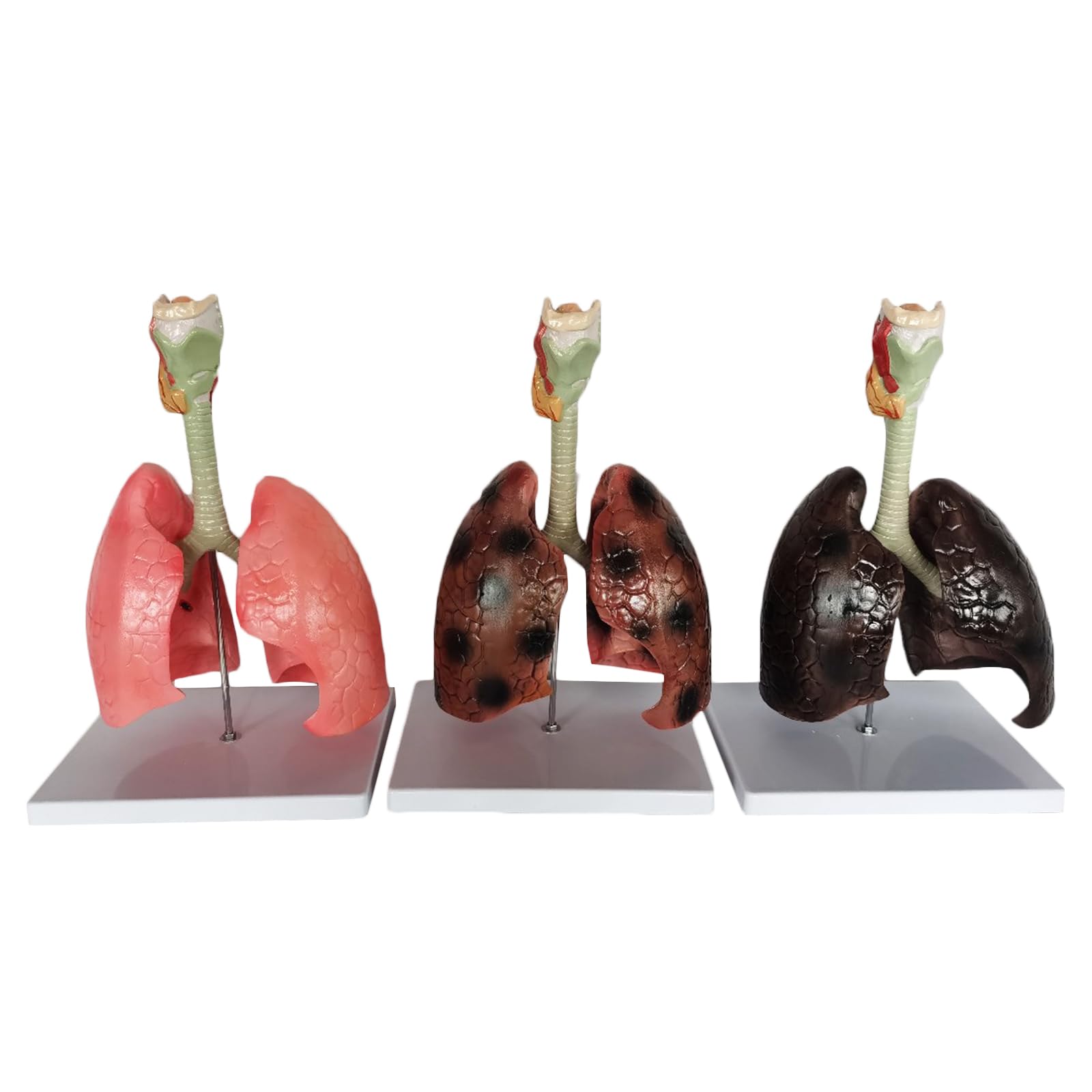 Smokers Lung Model and Healthy Lung Model - Life Size Human Lung Anatomy Model - for Emonstrate The Effects of Smoking on Lung Health,Flesh,20cm