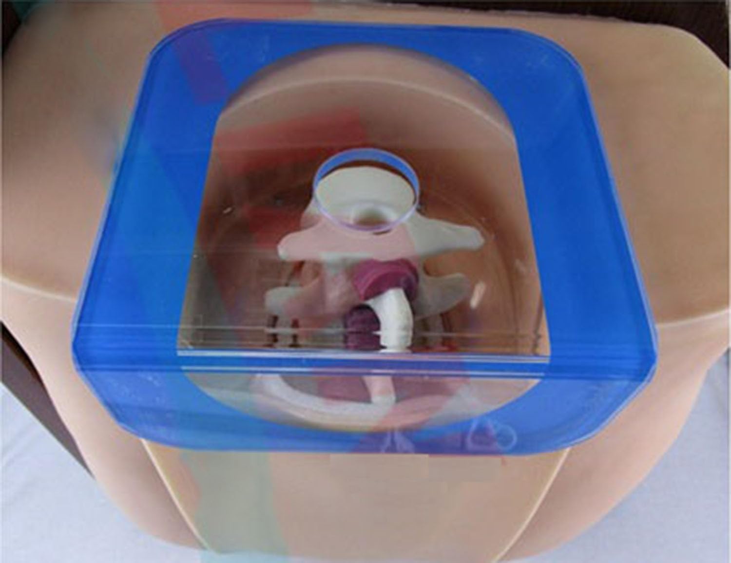 Symulator nakłucia lędźwiowego dla dorosłych, model do nauki nakłucia kręgosłupa, model do nauki klinicznego znieczulenia podpajęczynówkowego i zewnątrzoponowego, model do nauki umiejętności.