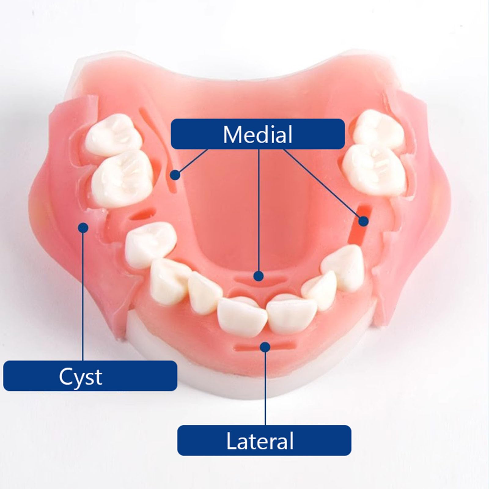 Modello di Simulazione di addestramento Orale Dentale Modello di Simulazione parodontale Strumento di Formazione per competenze mediche,Upper jaw-8cm