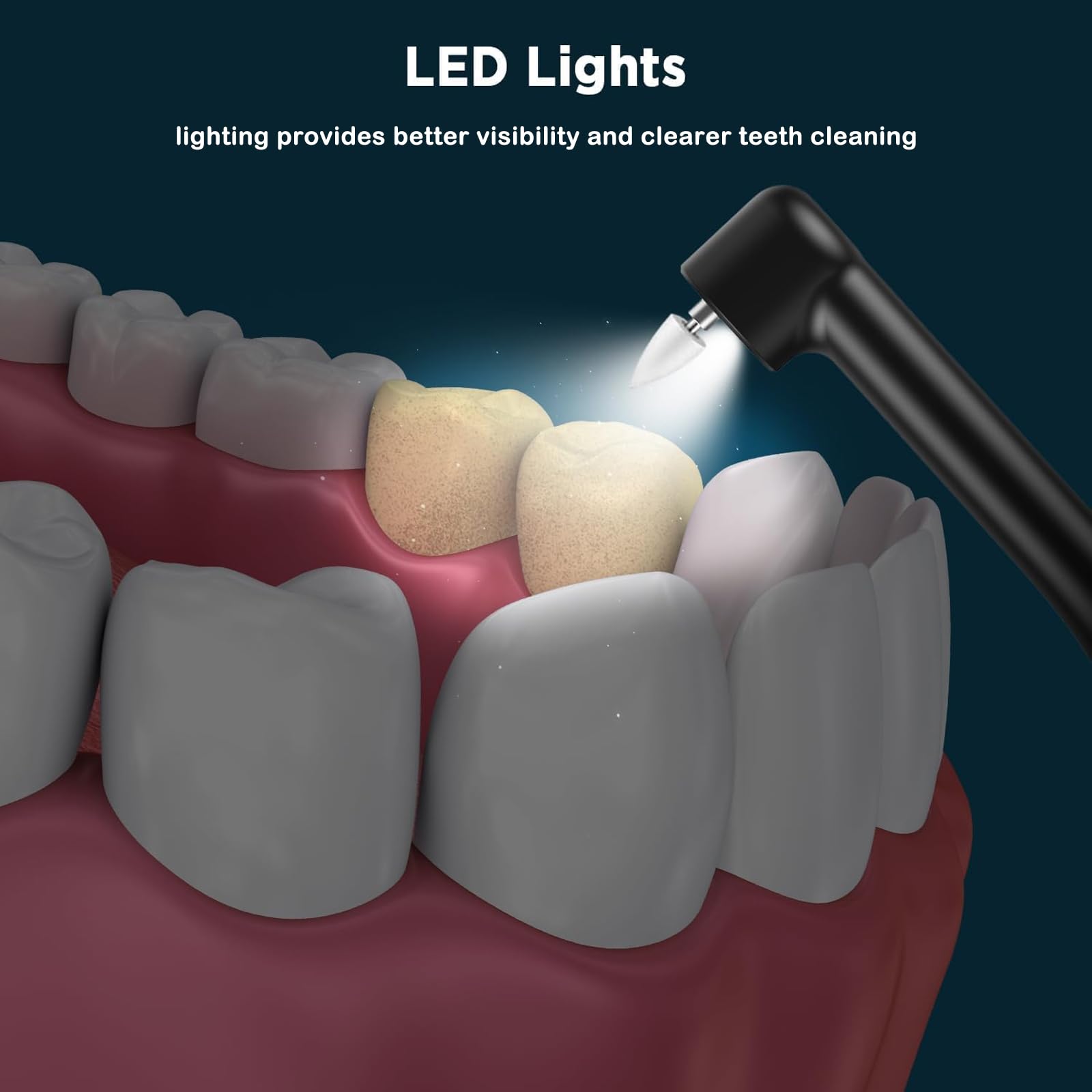 Lucidatrice elettrica per denti, rimozione delle macchie di placca con 6 testine - Smacchiatore dentale per sbiancare i denti gialli