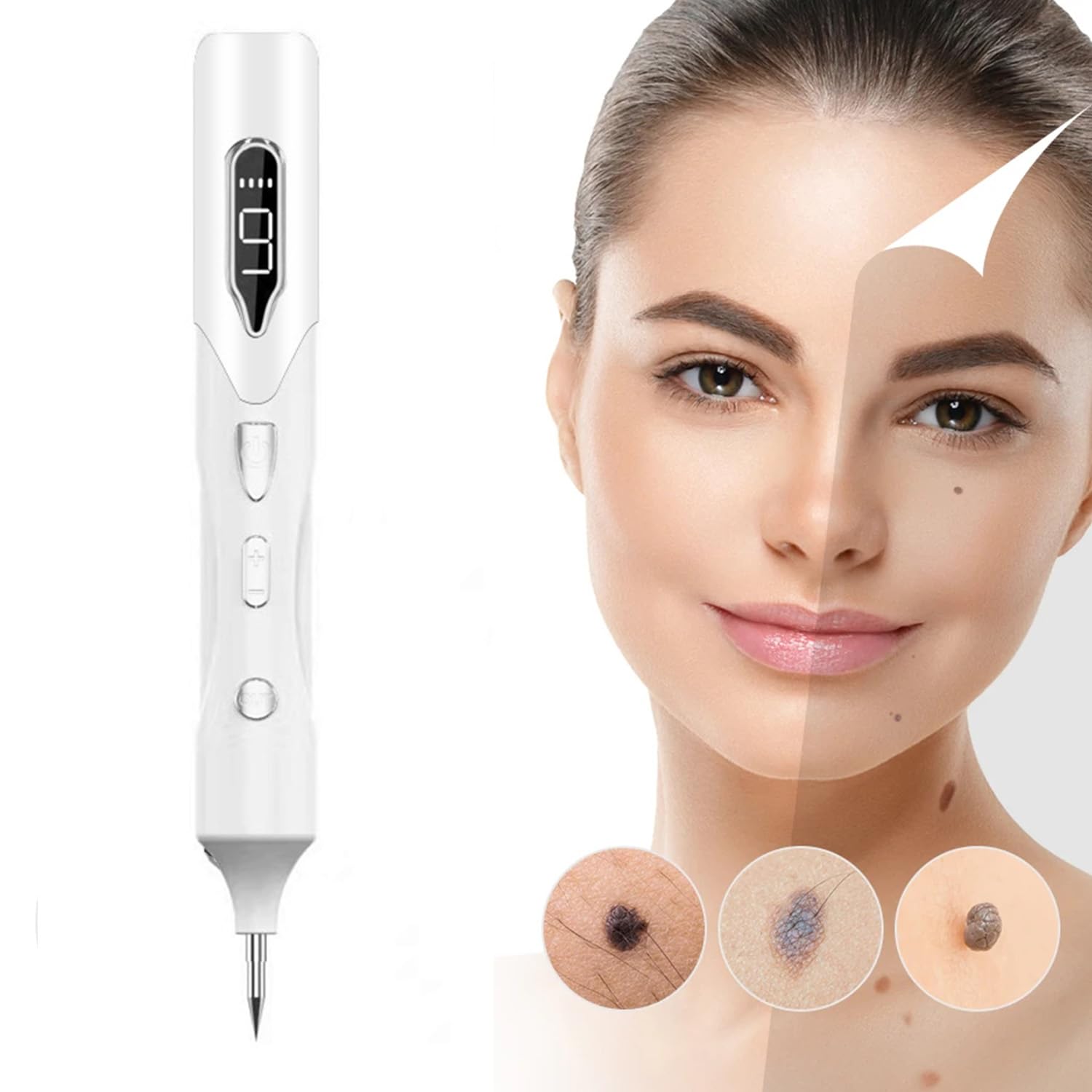 Laser Fibroblast Plasma Pen for Mole Dark Spot Freckle Nevus Wart Skin Tag Pimples Tattoo, Painless Tattoo Wart Speckle Remover Pen, Skin Tag Removal Kit Tools (white)