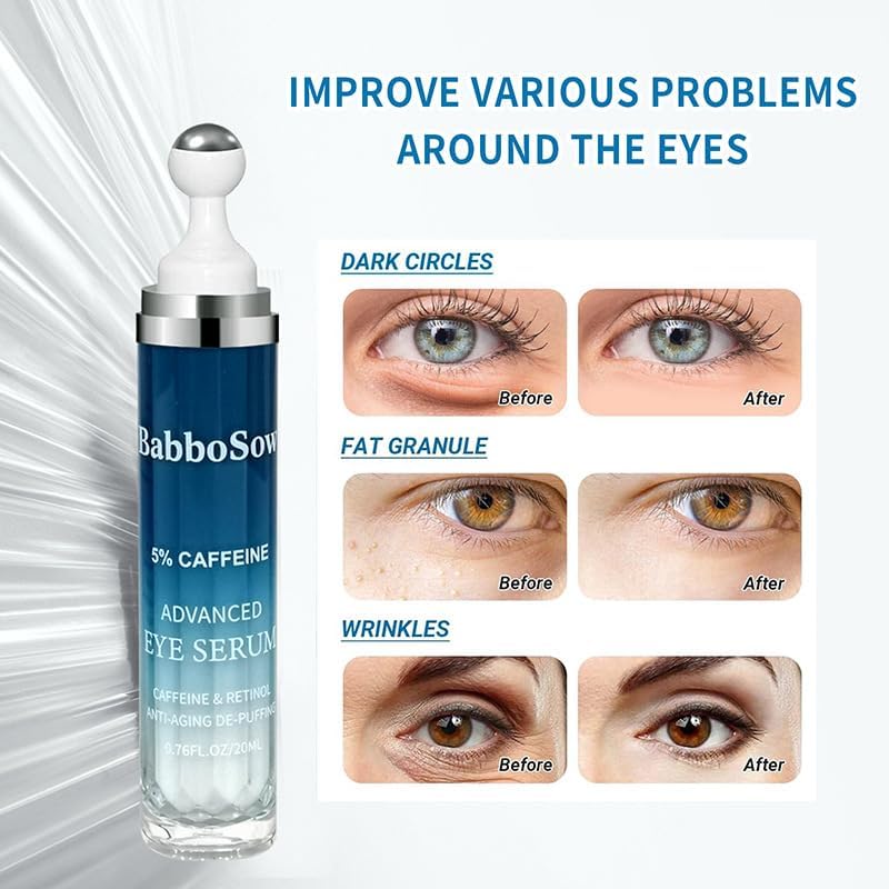 5% Caffeine & Retinol Eye Cream for Dark Circles, Puffiness & Wrinkles - Anti Aging Under Eye Serum with 360° Roller Ball - Men & Women Dark Circle Treatment - Image 3