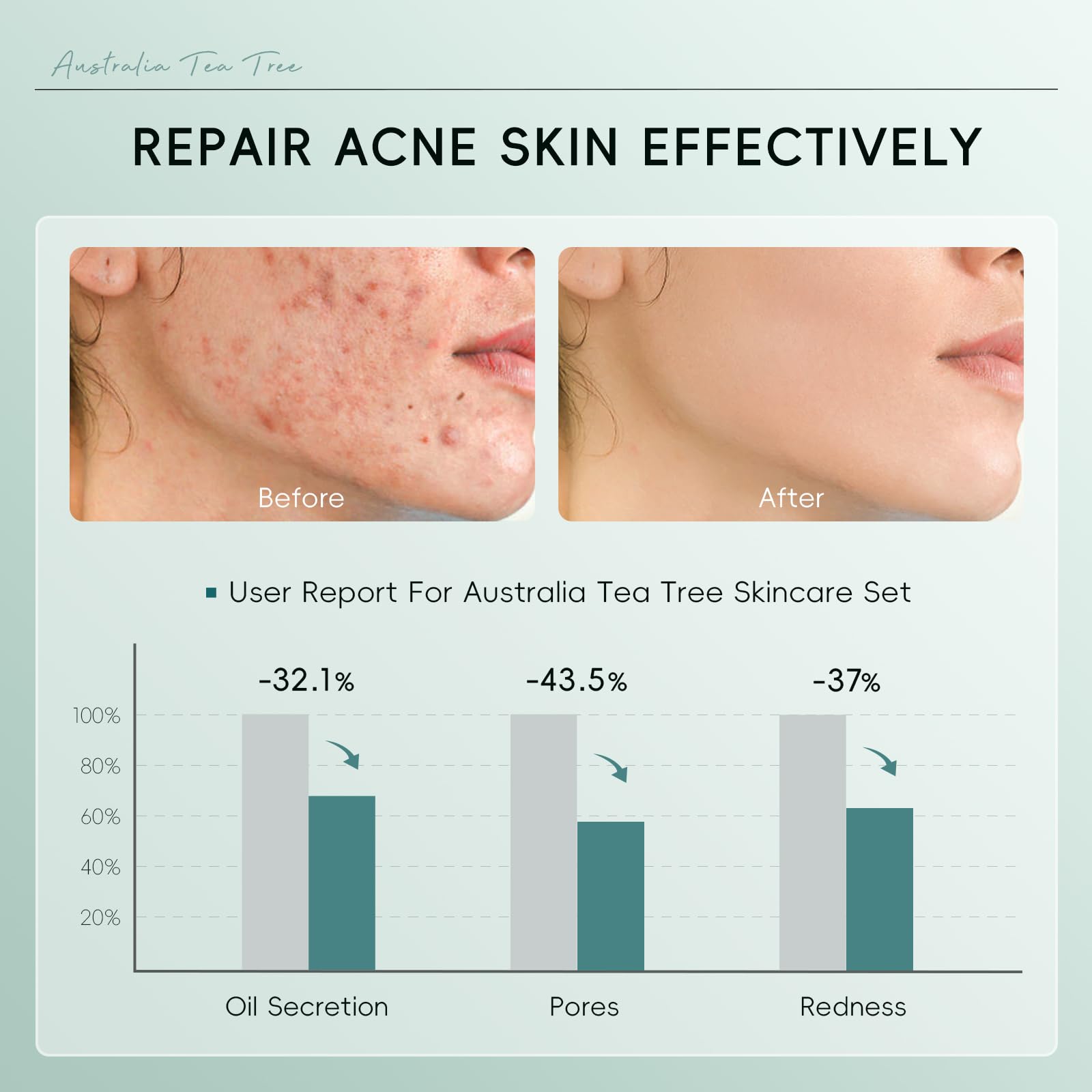 Zestaw do pielęgnacji skóry Skincare Routine Anti Trądzik, Drzewo herbaciane Zestaw do pielęgnacji skóry | 5 sztuk Rutyna Podróżna do twarzy, przeciw niedoskonałościom, oczyszczająca i kojąca, do skóry trądzikowej i trendu tłustego