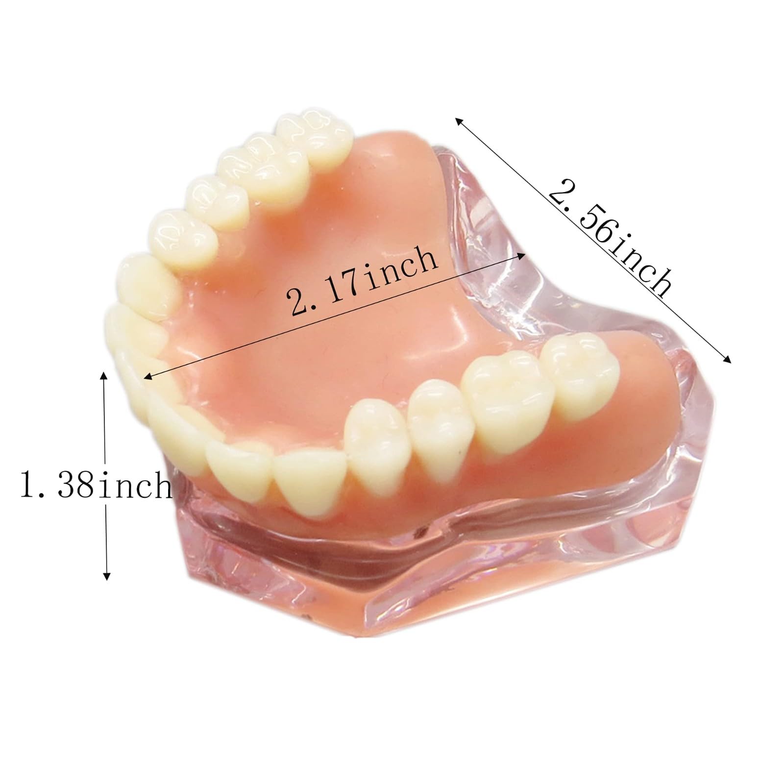 Modelo de dientes para implantes dentales tipodonto, rosa transparente, restauración de implantes dentales tipodonto, sobredentadura, 4 implantes, superior, demostración para estudio y enseñanza.