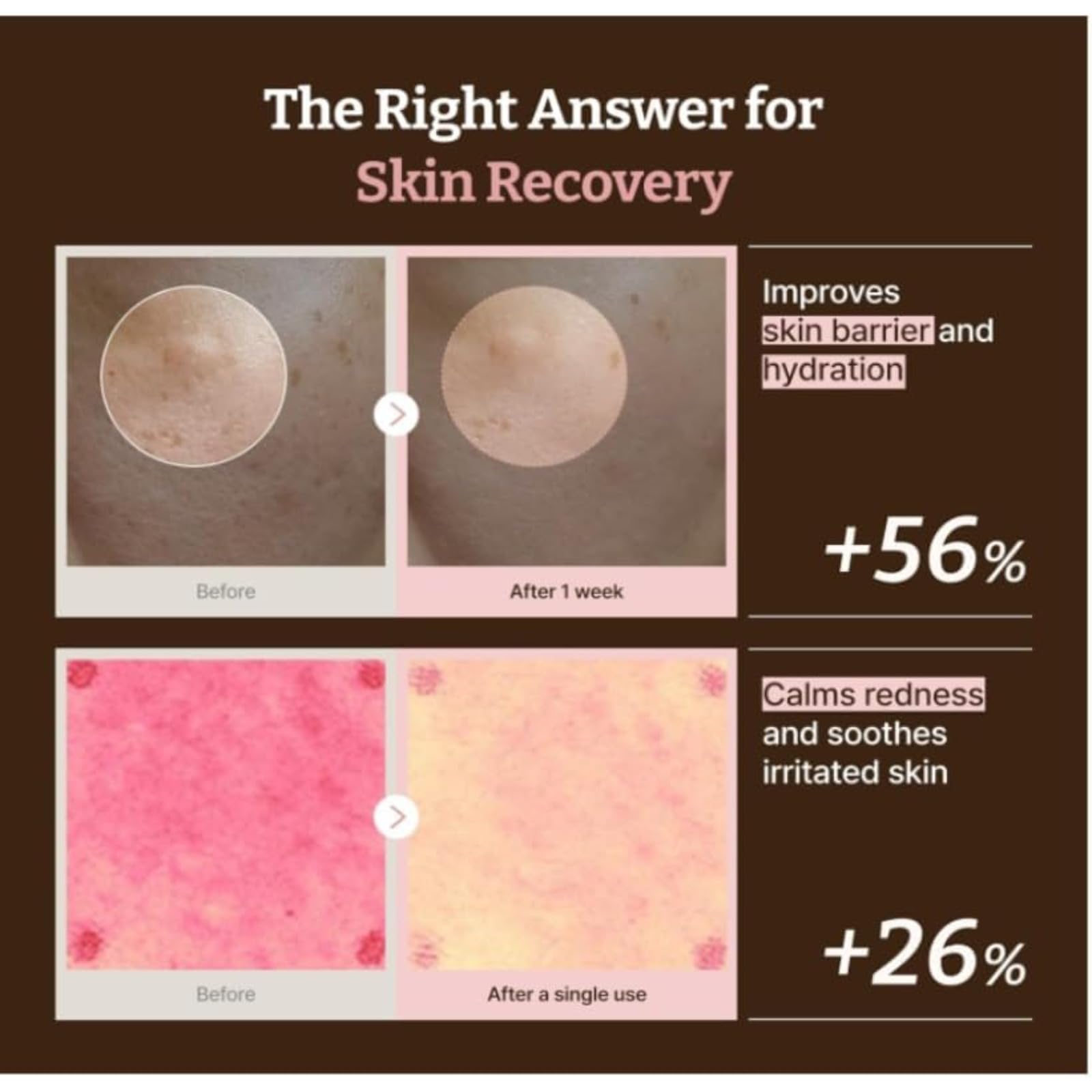 Dr Reju-all Advanced Pdrn Rejuvenating Cream con PDRN, niacinamida, colágeno, hidrata, reafirma y protege la piel en gel ligero de uso diario (2 Artículo)
