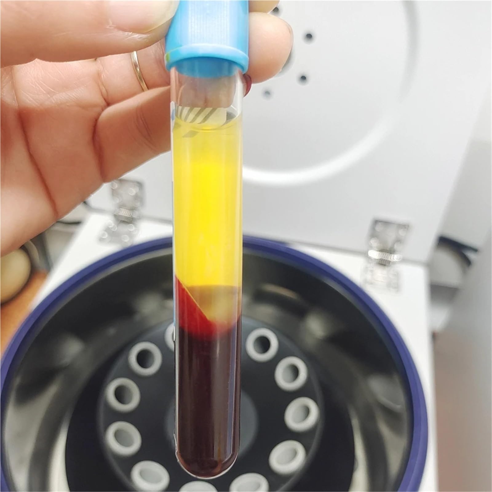 Odwirować, Wirówka laboratoryjna 4K o niskiej prędkości obrotowej separacyjna 4000 obr./min 10/15/20 ml wirówka plazmowa(4k host 24x10ml)