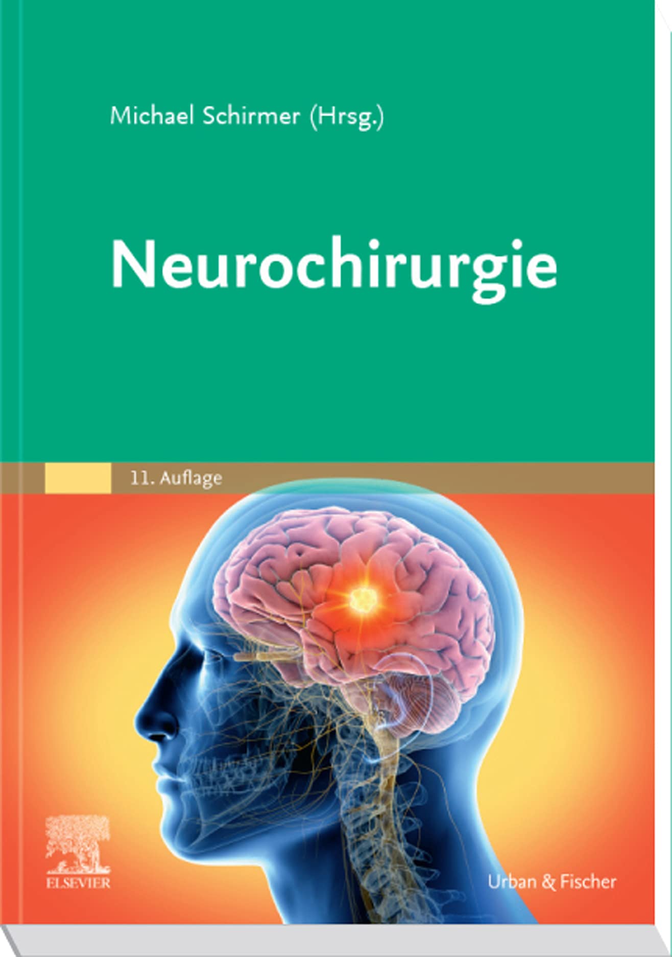 Neurochirurgie (MONOGRAPHIE - Fachbuch - Urban & Fischer-Verlag)