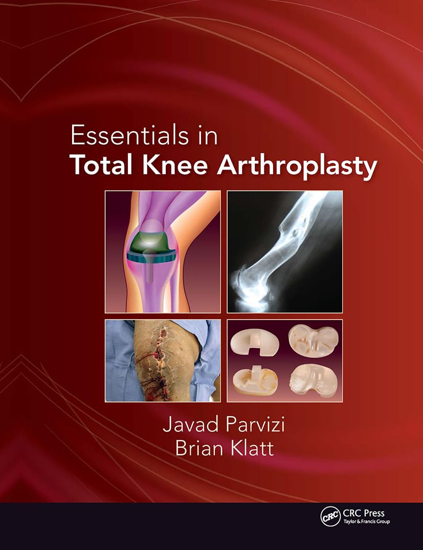 Essentials in Total Knee Arthroplasty (Parvizi,, Parvizi, Klatt..