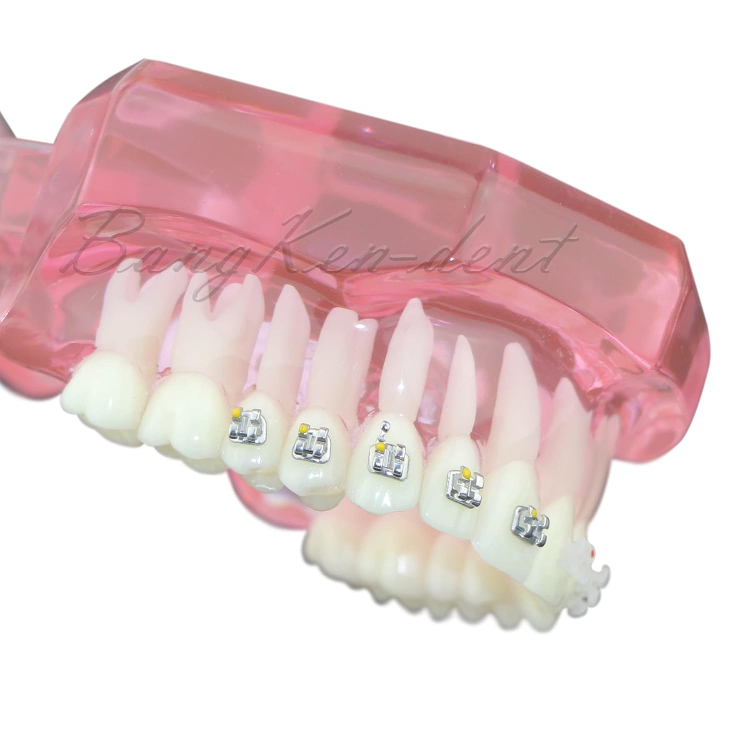 Buy Orthodontic Dental Model Typodont Metal Ceramic Brackets Braces