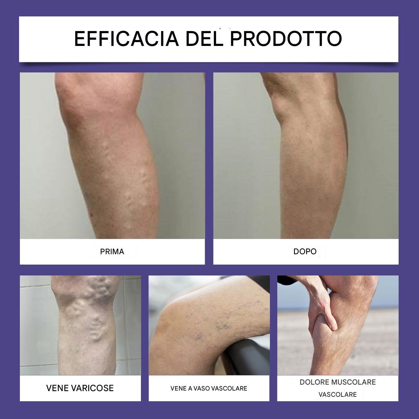 Penna Rimuovi Capillari,Strumento Allevia Fastidi Cutanei - Penna per la Cura delle Vene ad Azione Rapida per Salone, Casa, Post Parto, Esercizio, Viaggio, Campeggio, Notte, Persone Obese