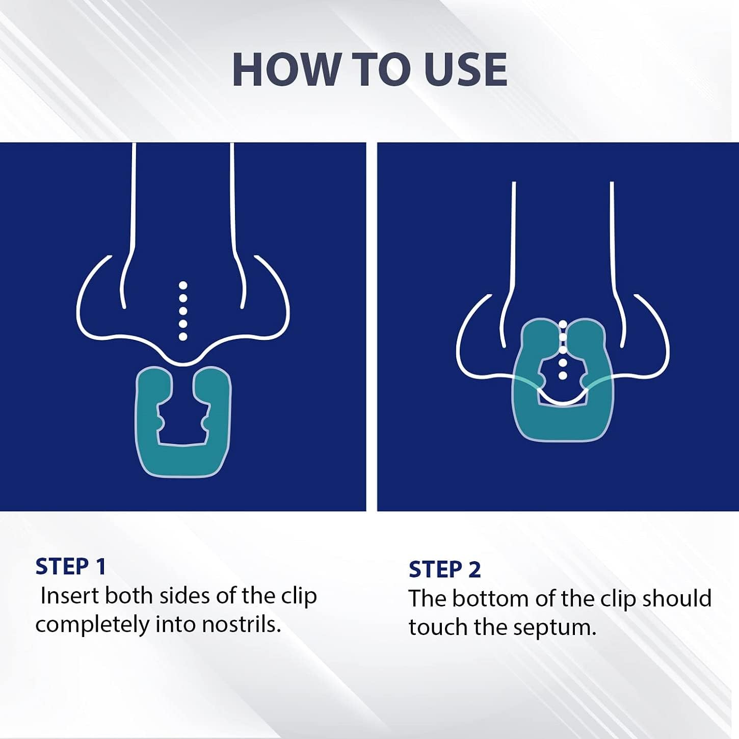 Skyloa Anti Snoring Devices