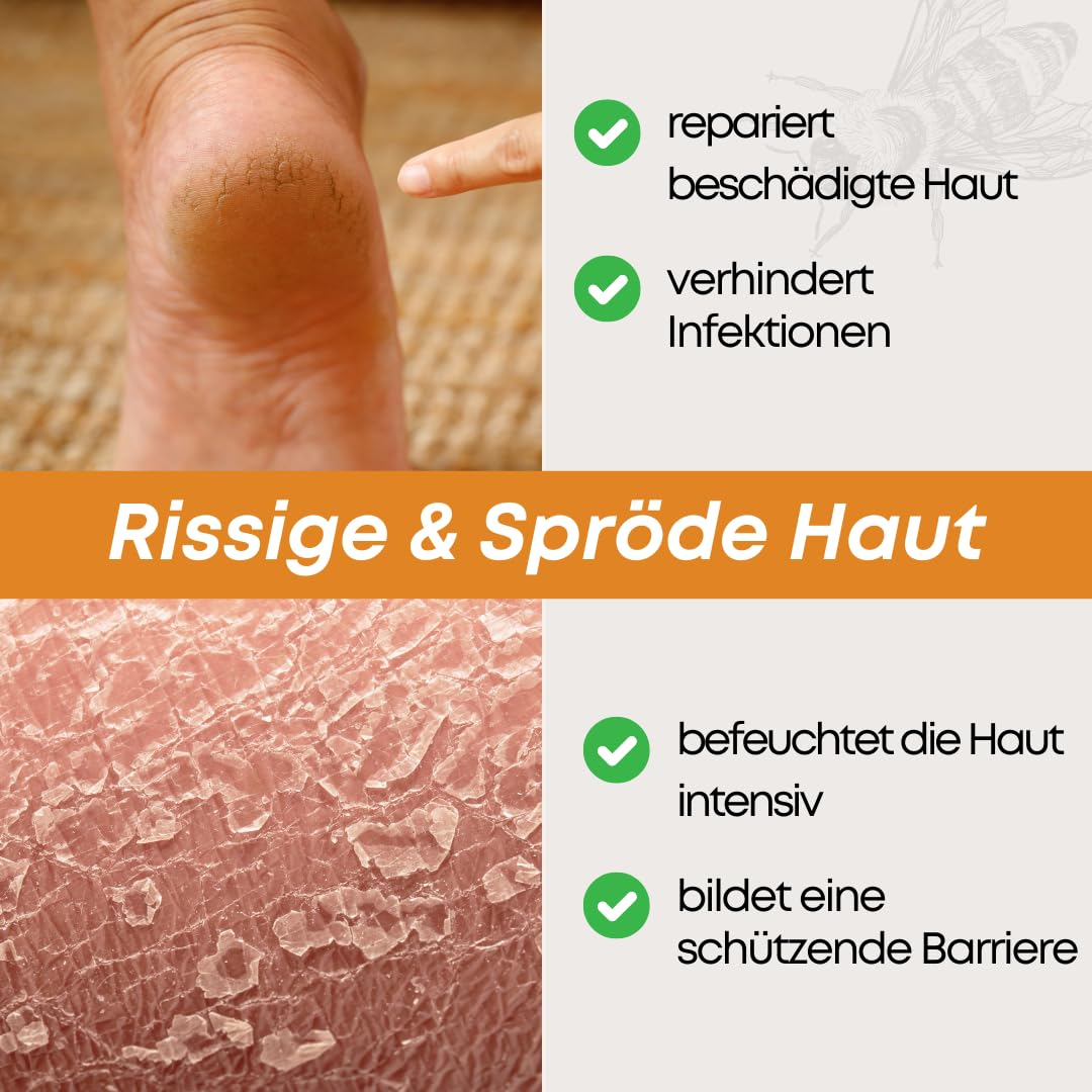 Zugsalbe & Wundsalbe 60g | Wund und Heilsalbe mit Calendula | Mighty Propolis Salbe | Wundheilsalbe | Salbe Gegen Juckreiz | Bee Enriched