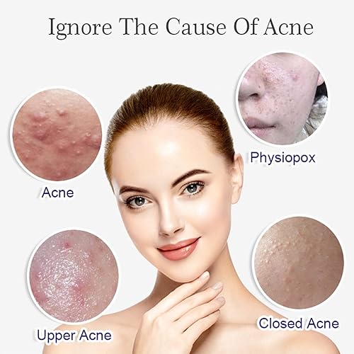 Miniatura 2 de AICHUN BEAUTY Suero facial Extracto de arroz natural Hidratante Anti-Acné Anti-Oxidación Refine Arrugas 1.4 fl oz/1.35fl.oz