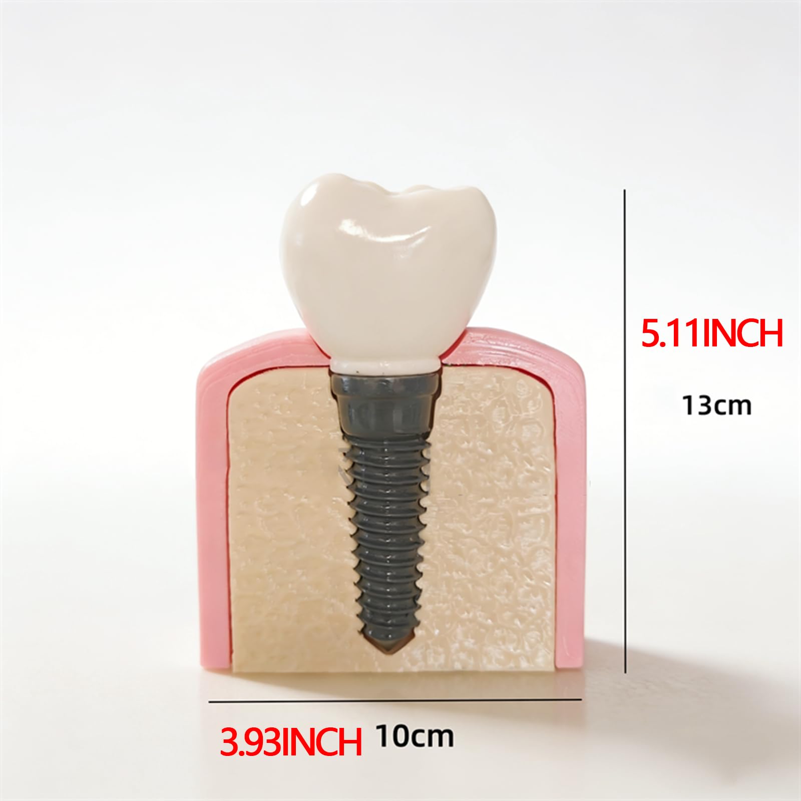 Modello di Dente in Resina per Clinica Ortodontica, Decorazione da Scrivania per Studio Dentistico o Regalo per Ortodontista