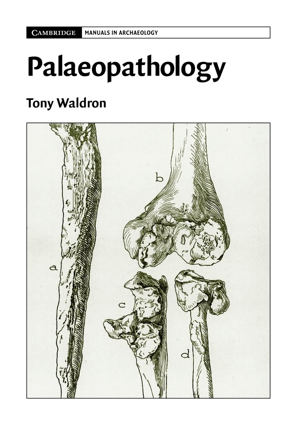 Palaeopathology (Cambridge Manuals in Archaeology)
