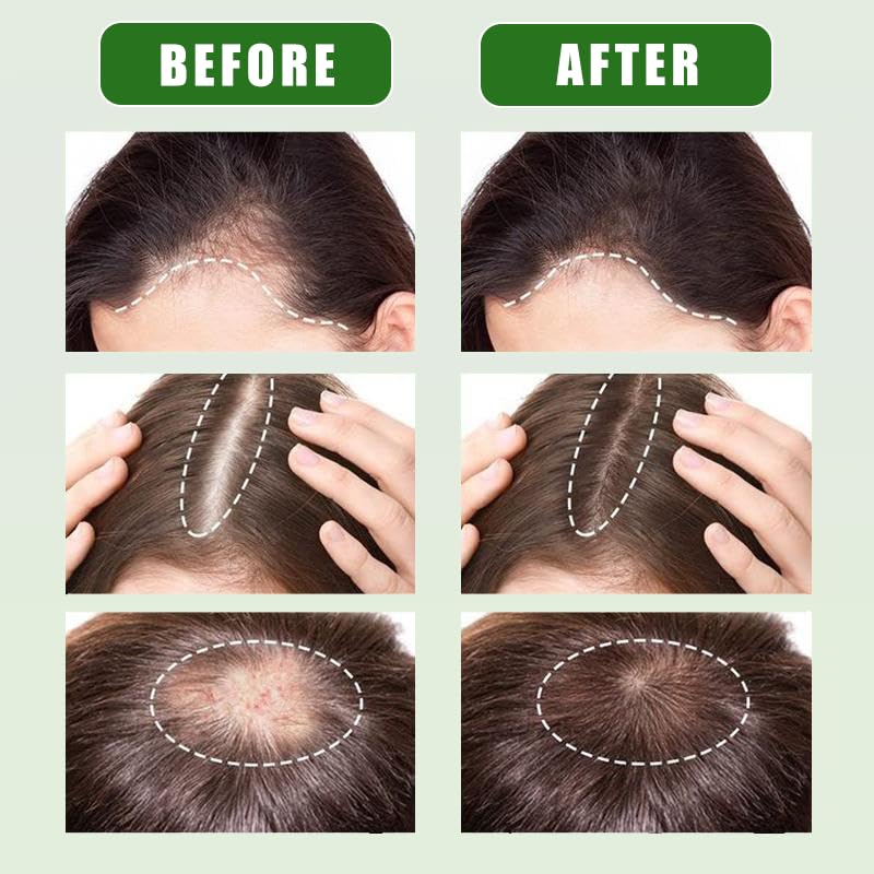 Miniatura 4 de Unalakleet Aceite de batana 100% crudo para el crecimiento del cabello  Aceite de Botana Tratamiento para el crecimiento del cabello con semillas de