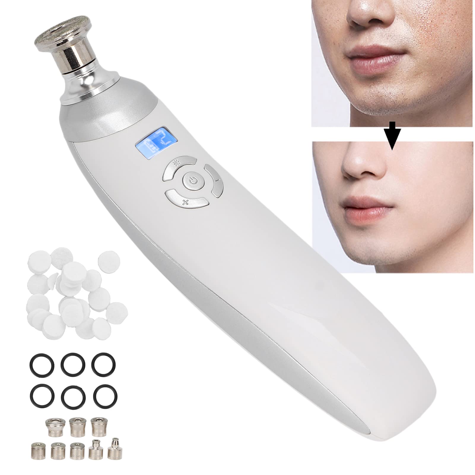 Machine de microdermabrasion diamant tenue dans la main, aspirateur de pores professionnel pour salon de soins de la peau