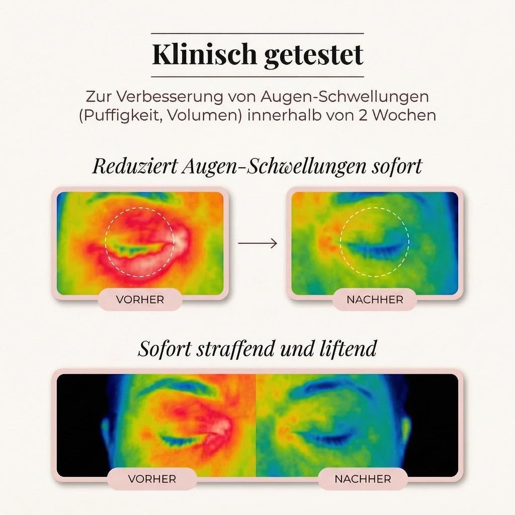 Solve Beauty, Peptid-Kollagen Hydrogel-Augenpads, solvene beauty augenpads mit Niacinamid Koffein Hyaluron, kühlende eye patches für frischer wirkende Augenpartie, 60 Stück Hydrogel Augenmaske