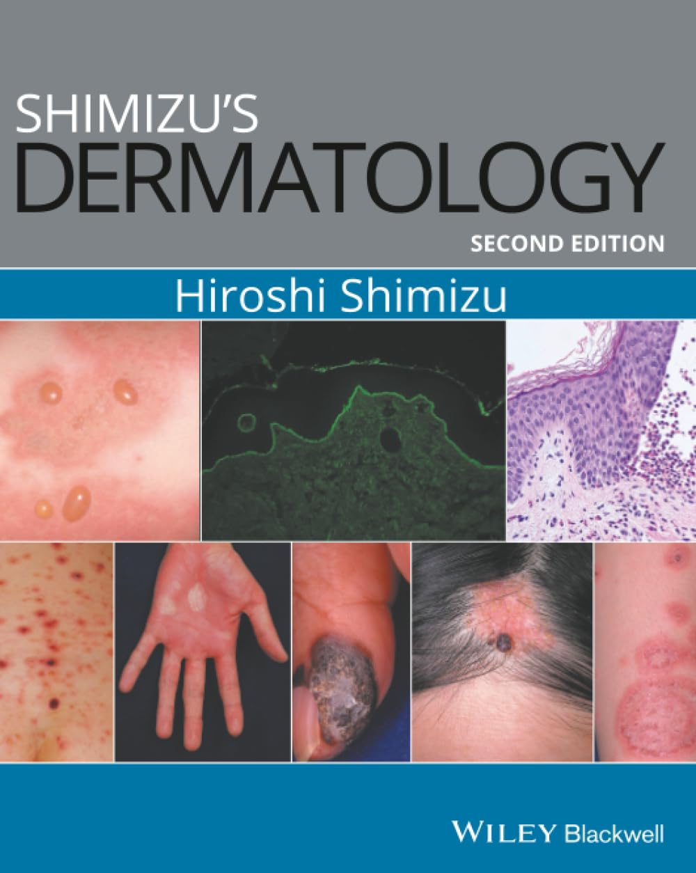 Shimizu's Dermatology by Hiroshi Shimizu - 9781119099055