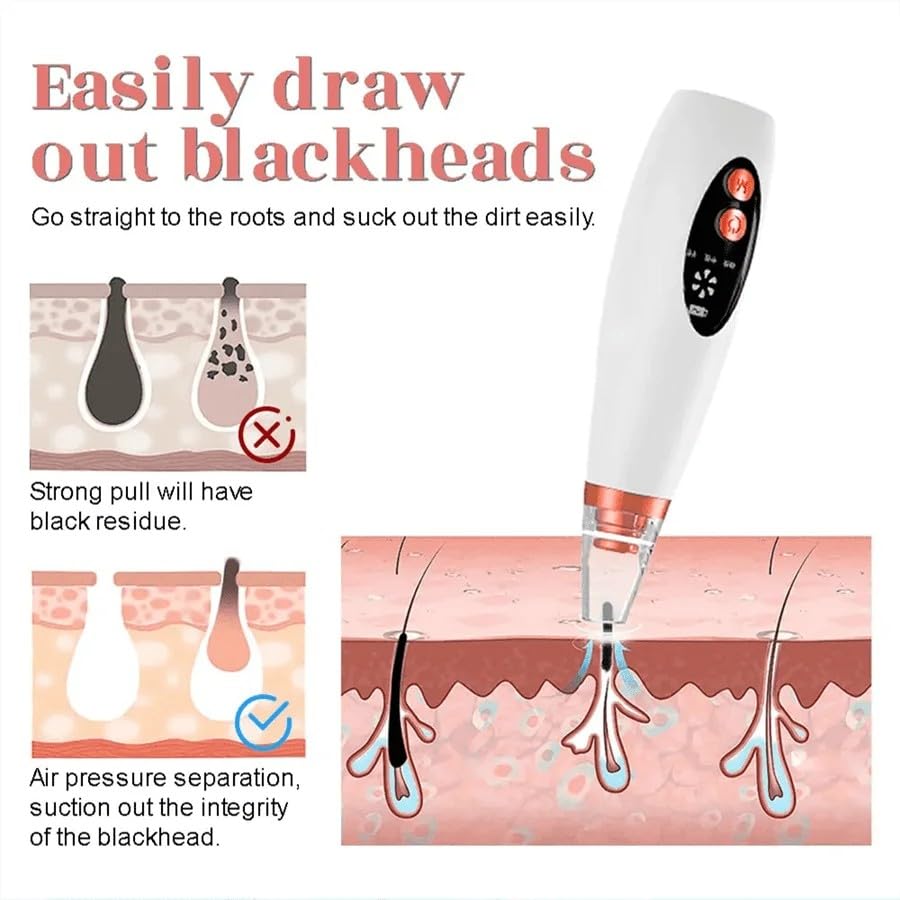 Image of Flying Monk Blackhead Remover, USB Rechargeable Pore Vacuum, Comedone Extractor with Strong Suction, Facial Deep Cleansing Device for Oily Normal Dry Skin