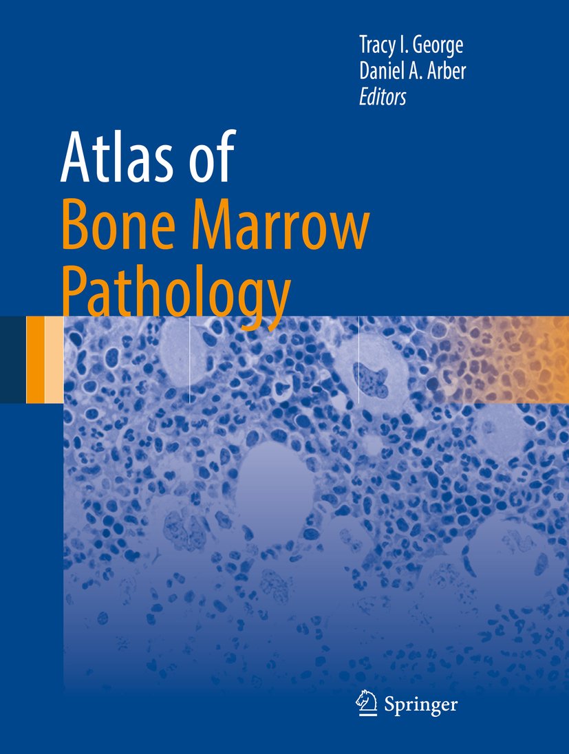 Atlas of Bone Marrow Pathology (Atlas of Anatomic Pathology) (English Edition)