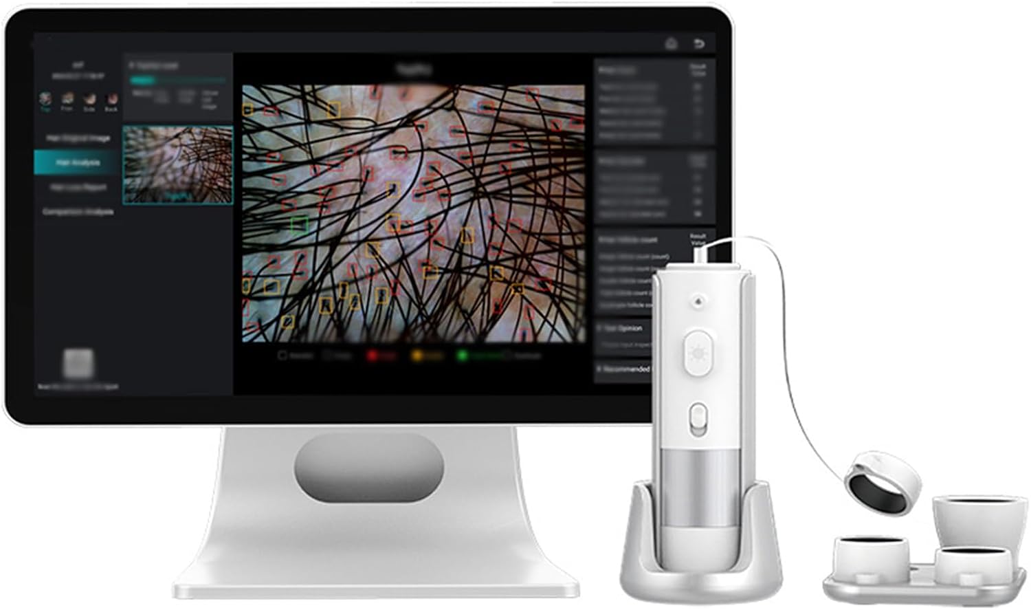 Professional Scalp Camera, High-Resolution Hair and Scalp Analysis Device with 4 Detection Lens, 200 Times Magnification, for Home, Beauty Salon Spa with Display