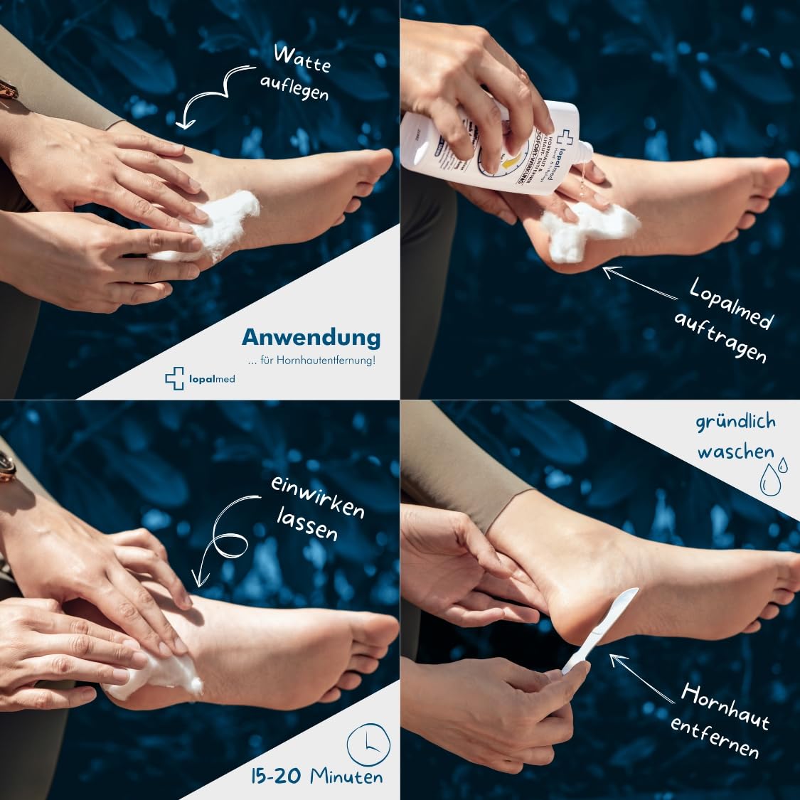 Lopalmed® Hornhaut & Nagelhaut Testbox [Sanfte & schnelle Anwendung!] – Hornhautentfernung ohne Raspel – Fußpflege gegen Hornhaut & Schwielen (Dermatologisch getestet & vegan)