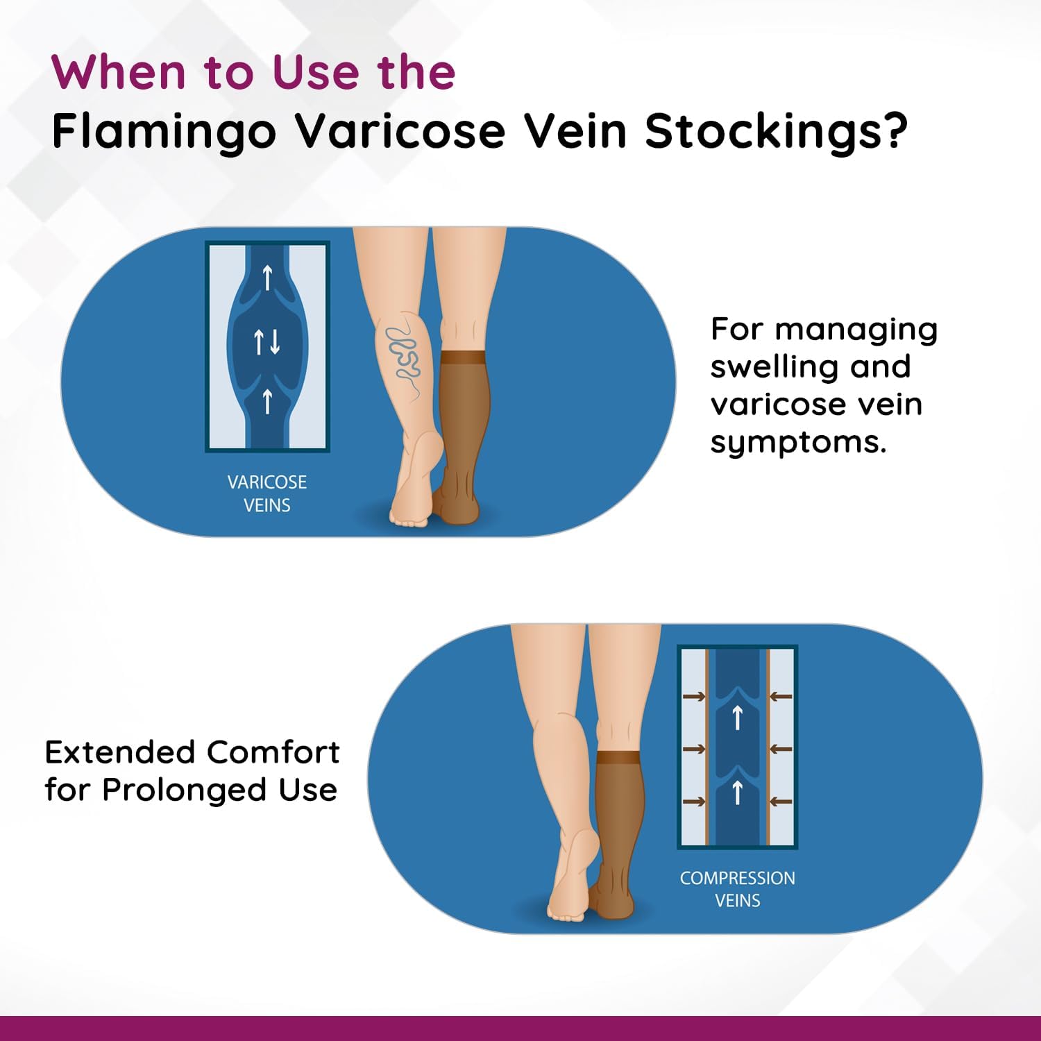 Flamingo Varicose Vein Stockings | Compression Stockings for Men & Women | Graduated Support for Leg Pain Relief & Blood Circulation | Size - Small | 1 Pair 3
