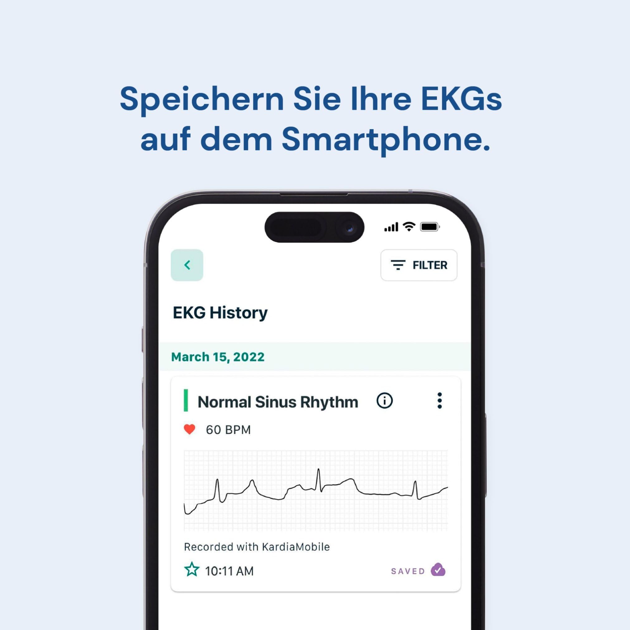 KardiaMobile 1-Kanal Personal-EKG Herzfrequenz-Monitor – zeichnet EKGs zu Hause auf, erkennt Vorhofflimmern, schnelle Ergebnisse, funktioniert mit den meisten Smartphones