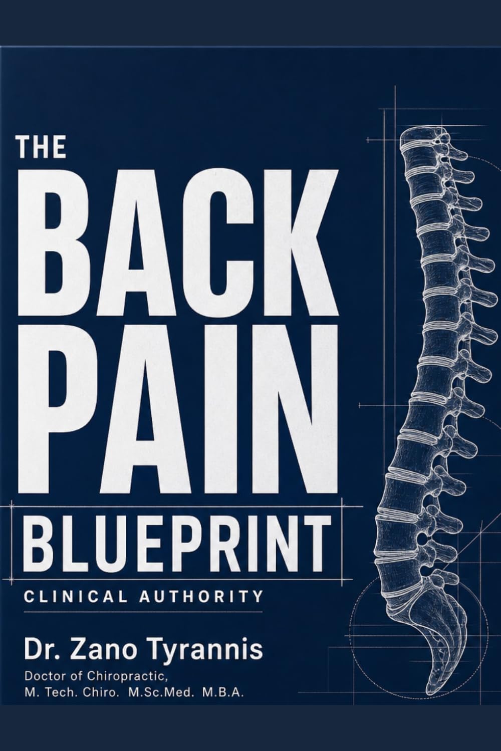 THE BACK PAIN BLUEPRINT: A Complete Guide to Understanding What's Really Wrong and What Actually Works