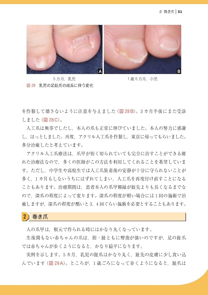 爪 基礎から臨床まで　改訂第2版 爪 基礎から臨床まで 改訂第2版 | 東 禹彦 |本 | 通販 | Amazon