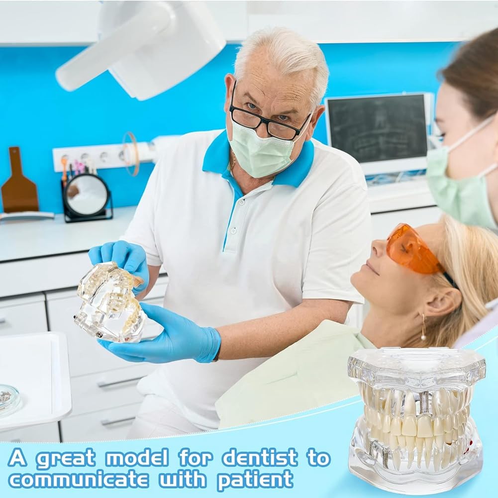 Typodonts Dental Modelo de Dientes para Implantes con Dientes Desmontables
