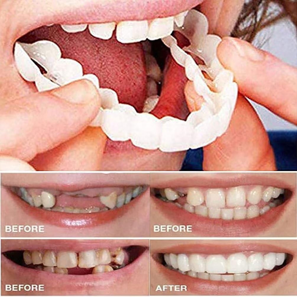 Womcare Kits de réparation temporaire de dents pour le remplissage de la dent cassée manquante et des lacunes, fausses dents malléables et kits de remplacement de perles thermiques